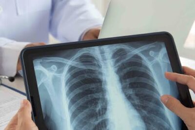 Máster en Radiología avanzada e imagen diagnóstica médica